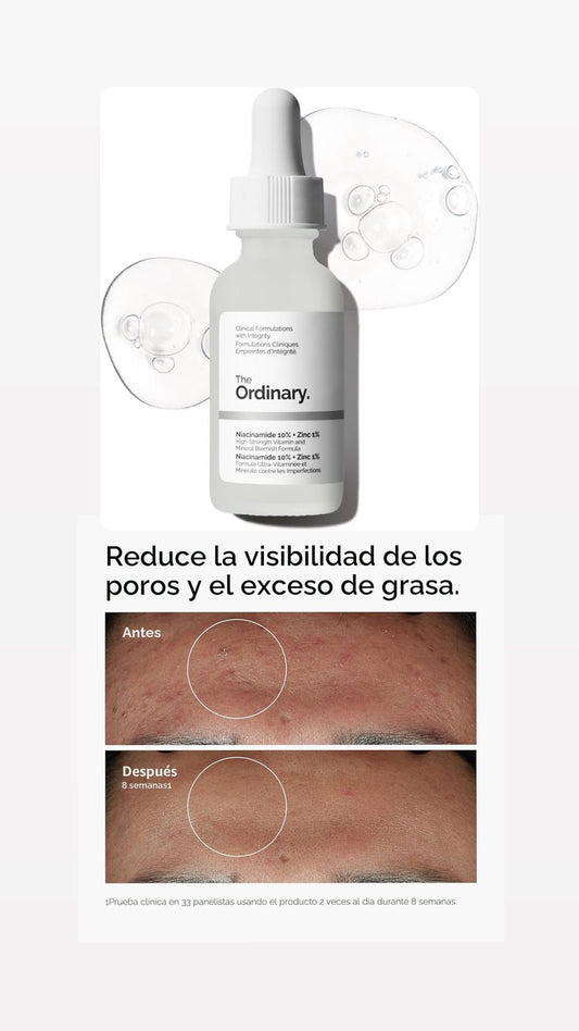 The Ordinary Niacinamide 10% + Zinc 1%